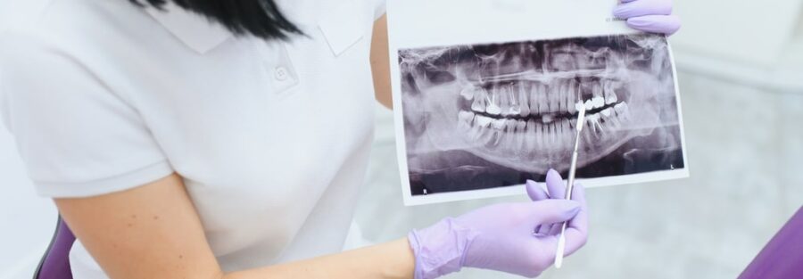 diagnostyka-obrazowa-w-stomatologii-rola-tomografii-komputerowej-i-pantomografii