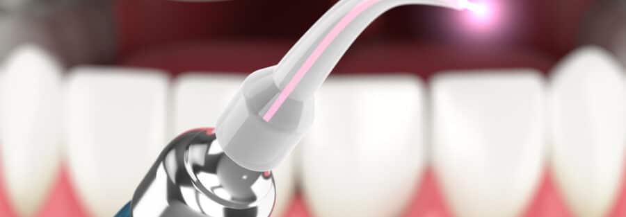 laseroterapia-w-stomatologii-zastosowania-i-korzysci-dla-pacjenta