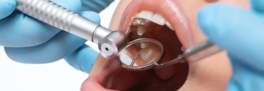 leczenie-prochnicy-nowoczesne-metody-wykrywania-i-usuwania-zmian-prochnicowych